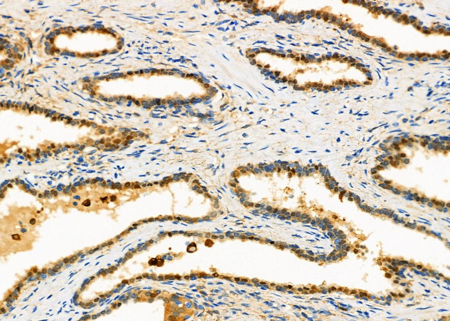 IFN beta Antibody in Immunohistochemistry (Paraffin) (IHC (P))