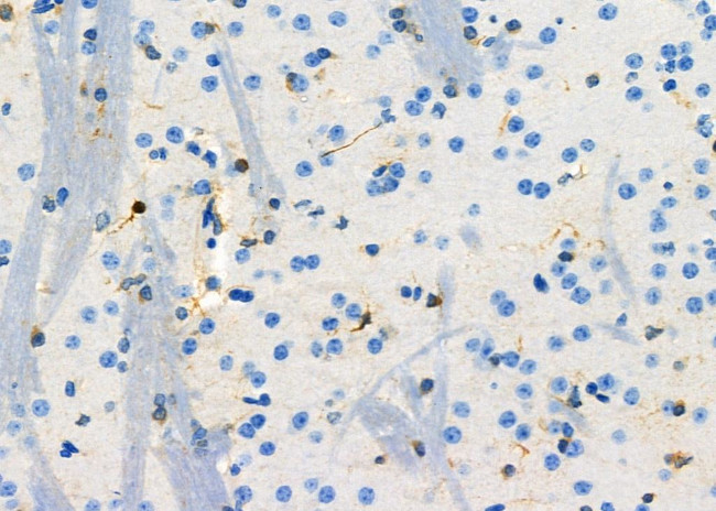 IFN beta Antibody in Immunohistochemistry (Paraffin) (IHC (P))