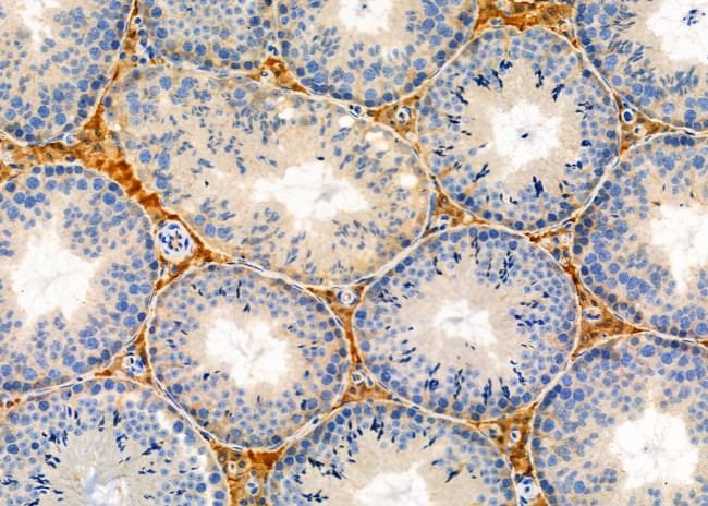 Factor IX Antibody in Immunohistochemistry (Paraffin) (IHC (P))