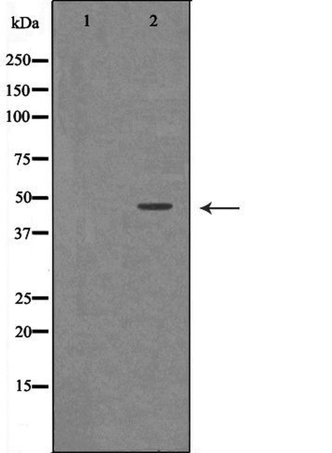 Renin Antibody in Western Blot (WB)