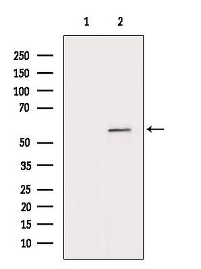 MYOC Antibody in Western Blot (WB)