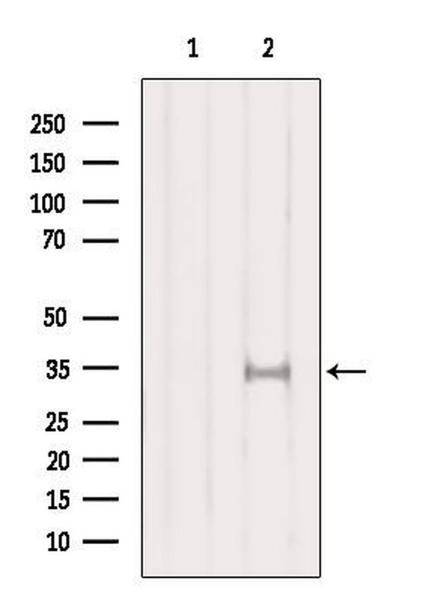 SULT1A1 Antibody in Western Blot (WB)