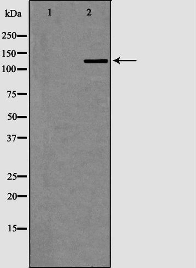 XPG Antibody in Western Blot (WB)