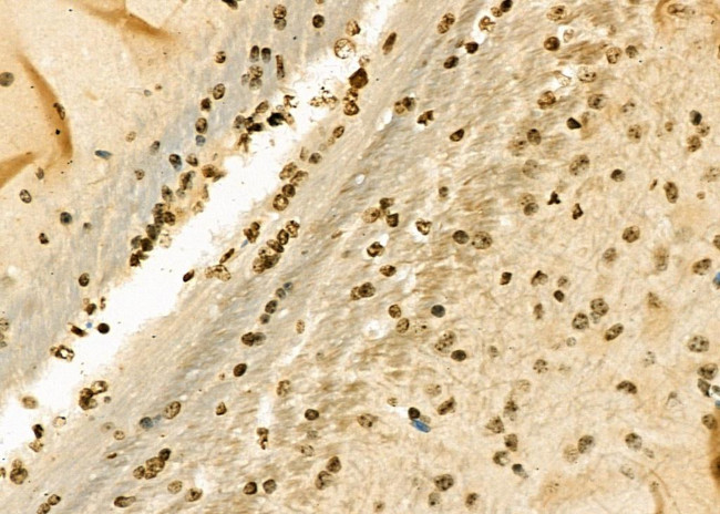 TAP2 Antibody in Immunohistochemistry (Paraffin) (IHC (P))