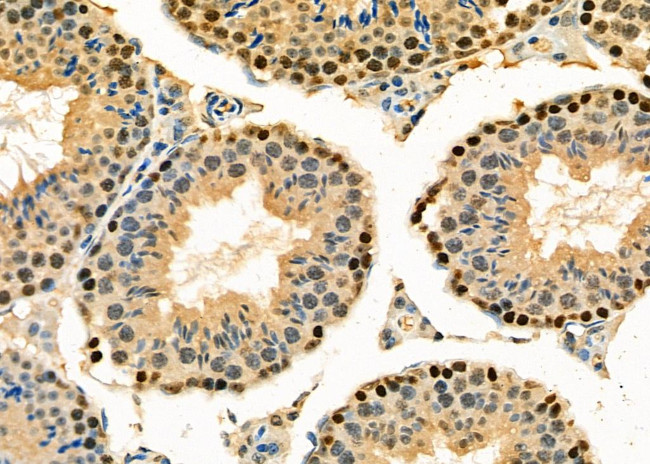 TAP2 Antibody in Immunohistochemistry (Paraffin) (IHC (P))