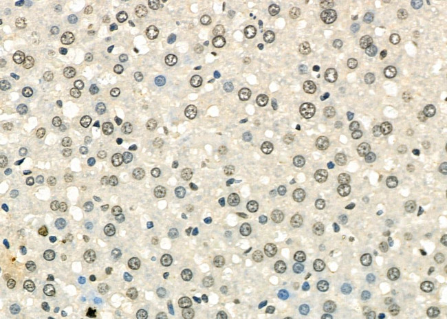 TAP2 Antibody in Immunohistochemistry (Paraffin) (IHC (P))