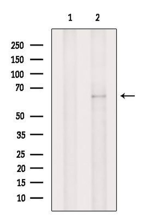 TAP2 Antibody in Western Blot (WB)