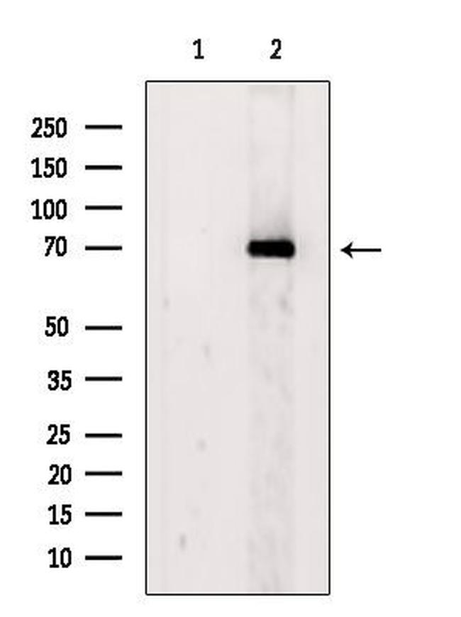 KPNA2 Antibody in Western Blot (WB)