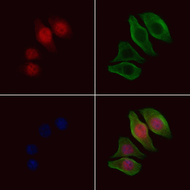 XPA Antibody in Immunocytochemistry (ICC/IF)