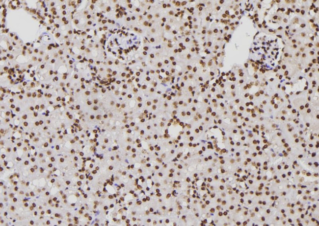 XPA Antibody in Immunohistochemistry (Paraffin) (IHC (P))