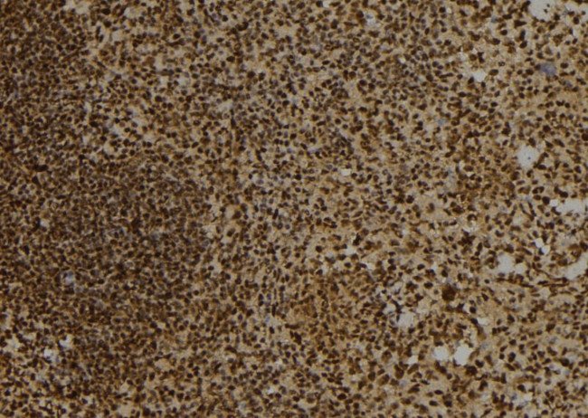 DTNBP1 Antibody in Immunohistochemistry (Paraffin) (IHC (P))