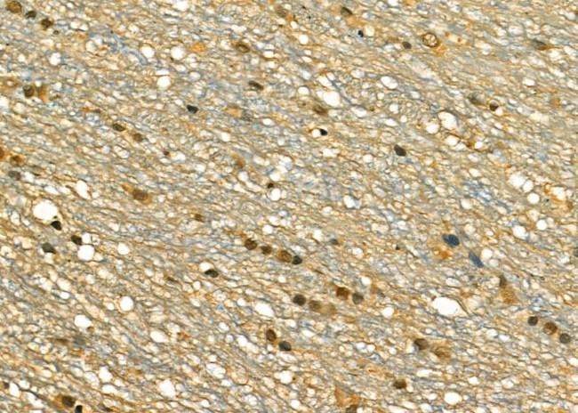 SRSF1 Antibody in Immunohistochemistry (Paraffin) (IHC (P))