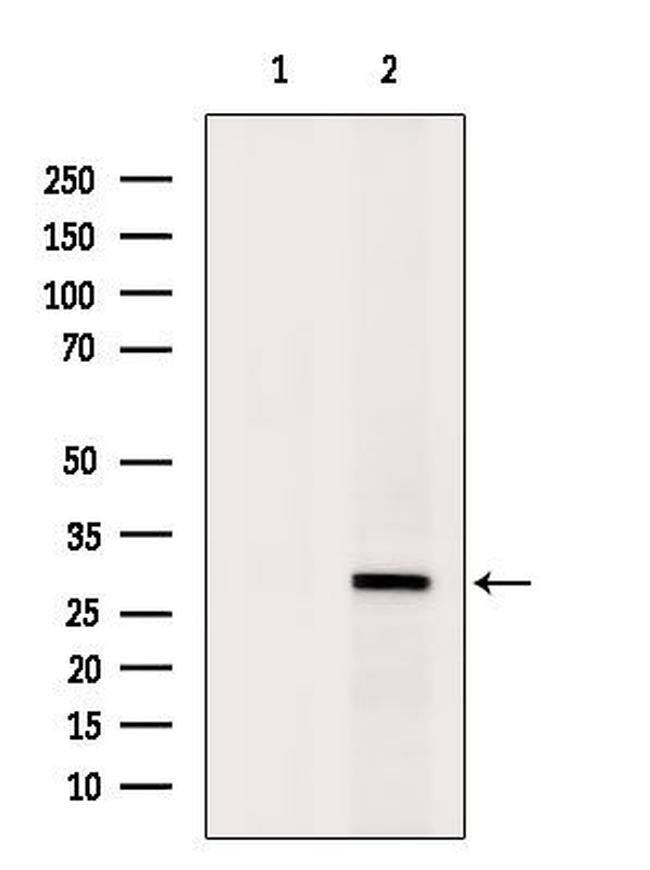 SRSF1 Antibody in Western Blot (WB)