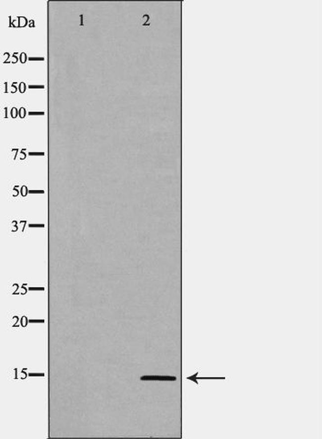 SAA1/SAA2 Antibody in Western Blot (WB)