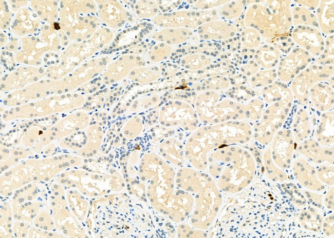 CD162 Antibody in Immunohistochemistry (Paraffin) (IHC (P))