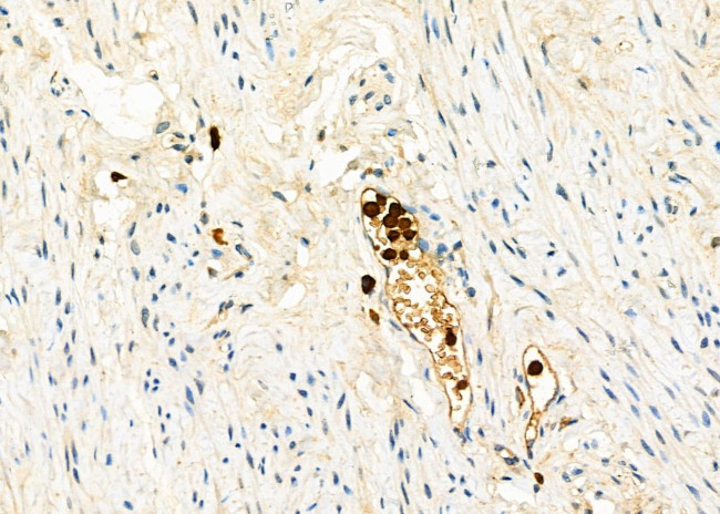 CD162 Antibody in Immunohistochemistry (Paraffin) (IHC (P))