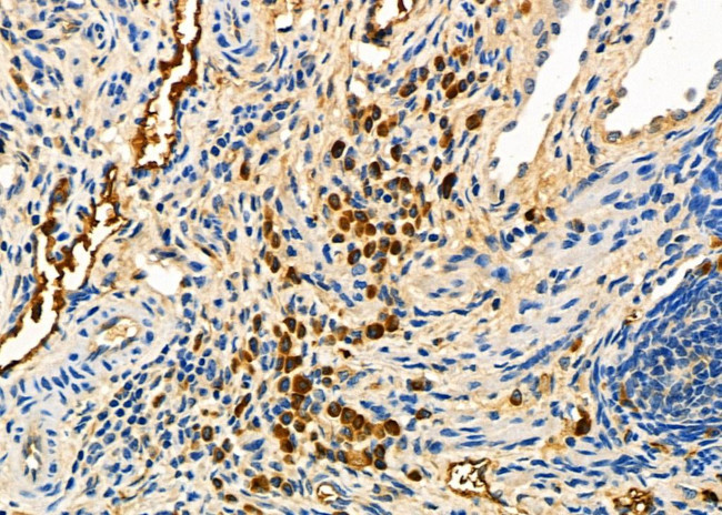 CD162 Antibody in Immunohistochemistry (Paraffin) (IHC (P))