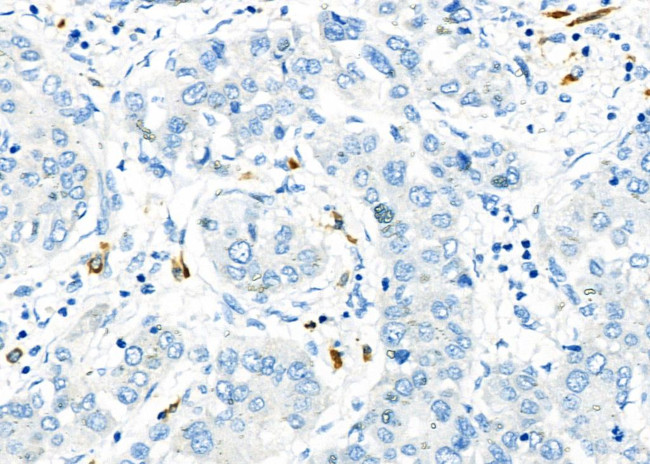 CD162 Antibody in Immunohistochemistry (Paraffin) (IHC (P))
