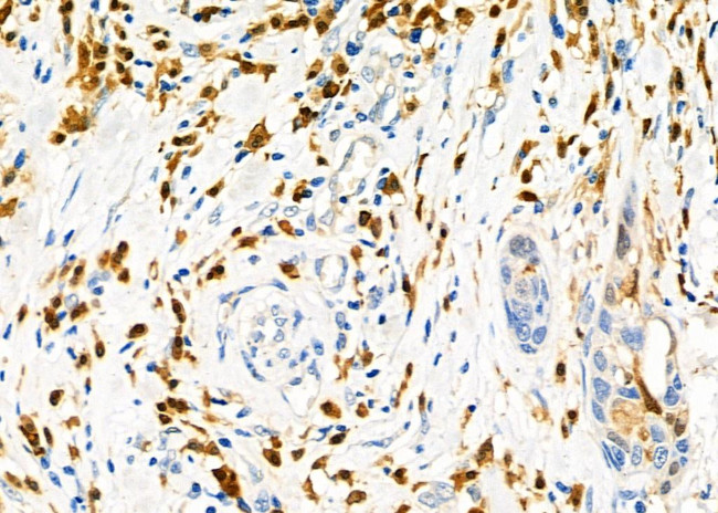 CD162 Antibody in Immunohistochemistry (Paraffin) (IHC (P))