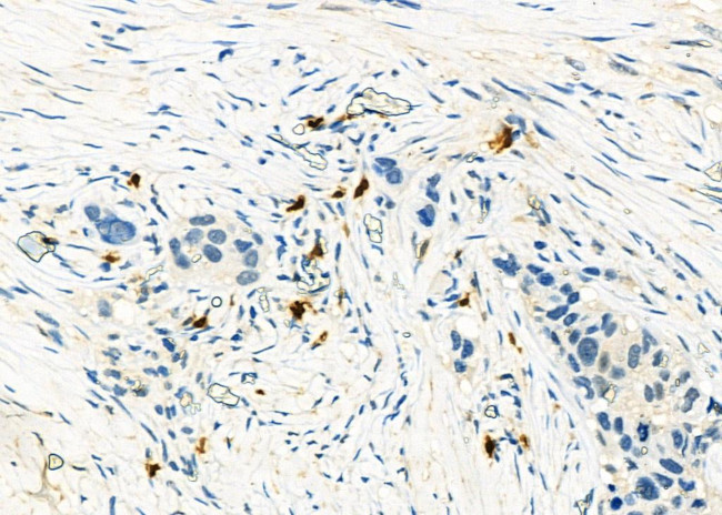 CD162 Antibody in Immunohistochemistry (Paraffin) (IHC (P))