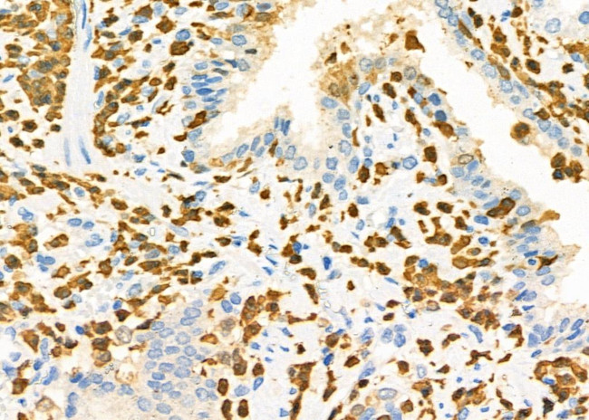 CD162 Antibody in Immunohistochemistry (Paraffin) (IHC (P))