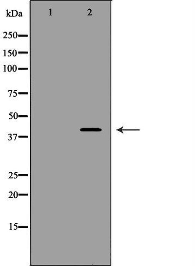 CDK7 Antibody in Western Blot (WB)