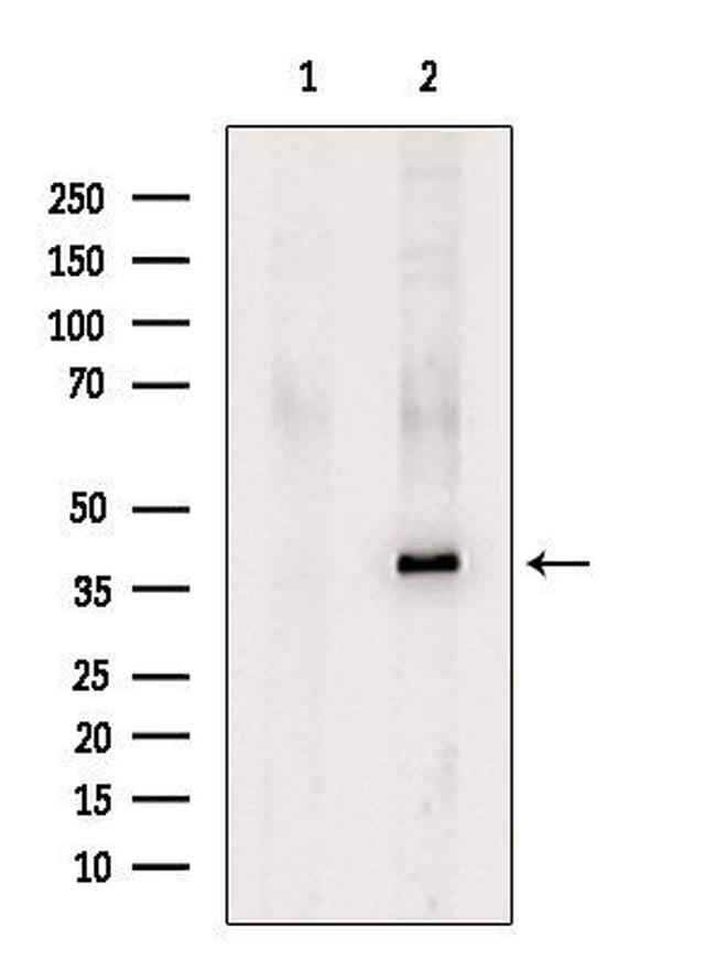 KIR2DL1 Antibody in Western Blot (WB)