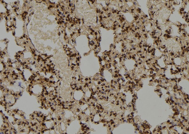 CSN5 Antibody in Immunohistochemistry (Paraffin) (IHC (P))