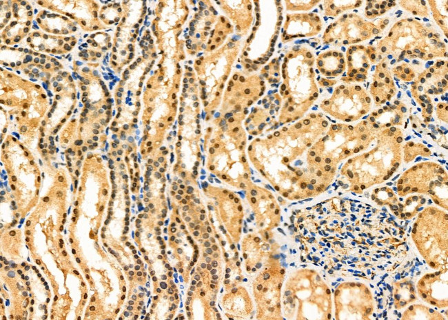 CSN5 Antibody in Immunohistochemistry (Paraffin) (IHC (P))