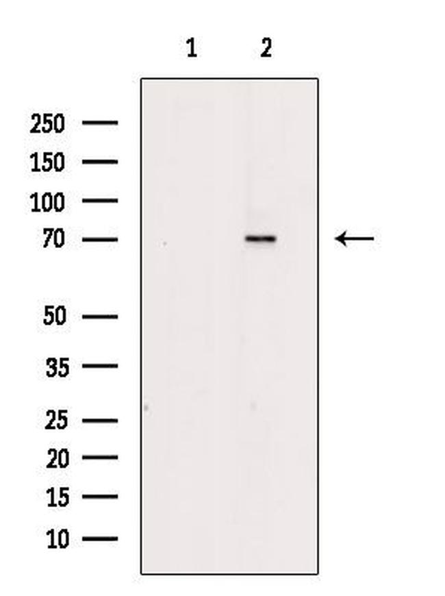 IFNAR2 Antibody in Western Blot (WB)