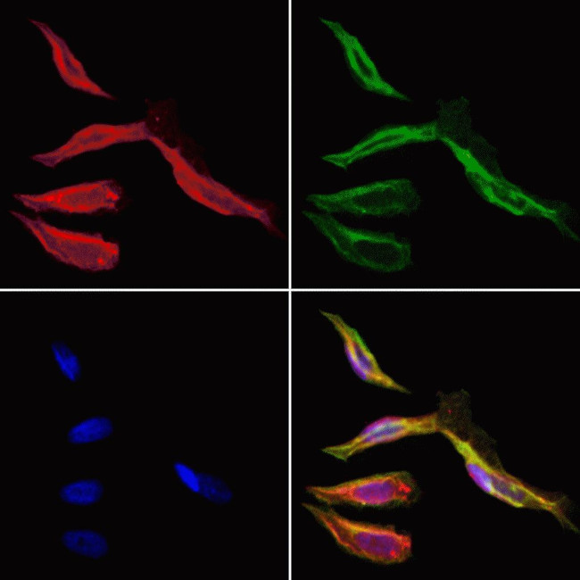 HMBS Antibody in Immunocytochemistry (ICC/IF)