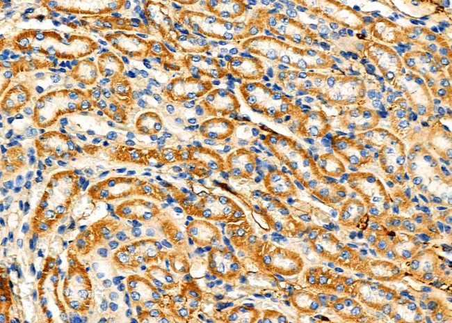 HMBS Antibody in Immunohistochemistry (Paraffin) (IHC (P))