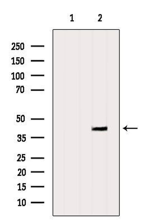 HMBS Antibody in Western Blot (WB)