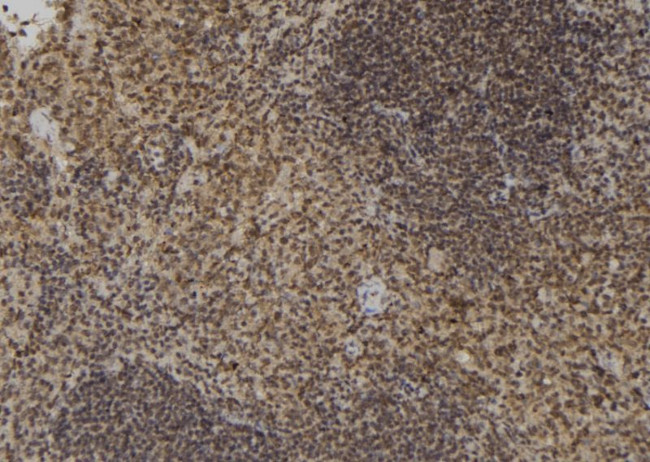 XRCC2 Antibody in Immunohistochemistry (Paraffin) (IHC (P))