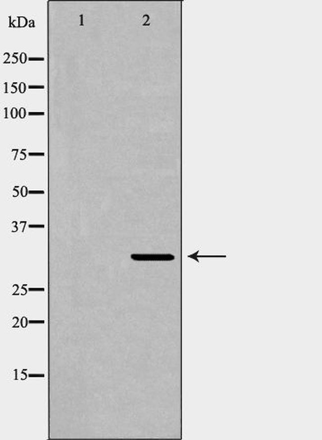 XRCC2 Antibody in Western Blot (WB)