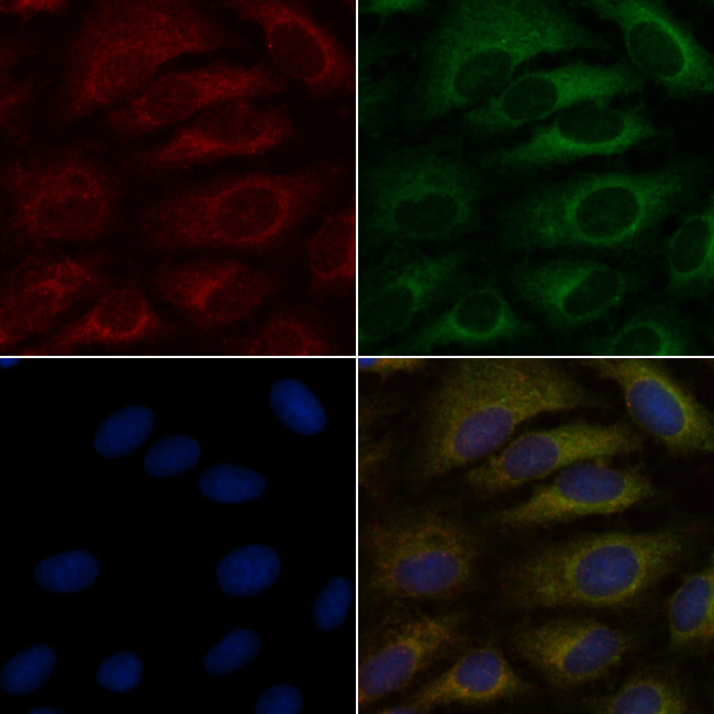 SLC22A6 Antibody in Immunocytochemistry (ICC/IF)