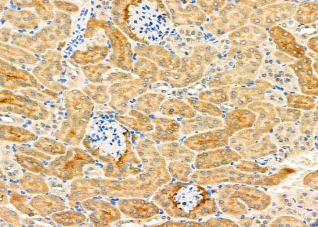 SLC22A6 Antibody in Immunohistochemistry (Paraffin) (IHC (P))