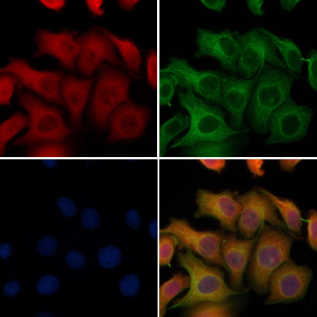 SFTPC Antibody in Immunocytochemistry (ICC/IF)