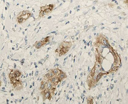 SFTPC Antibody in Immunohistochemistry (Paraffin) (IHC (P))