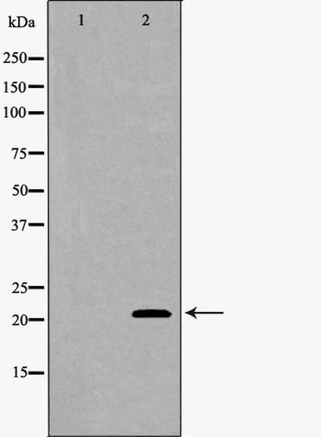 SFTPC Antibody in Western Blot (WB)