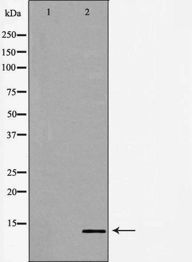 POLR2J Antibody in Western Blot (WB)