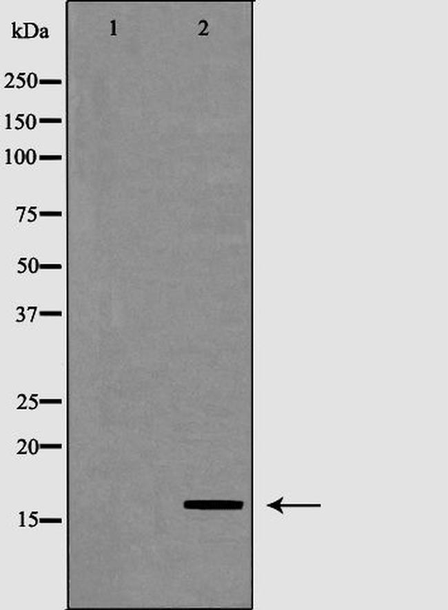 POLR2D Antibody in Western Blot (WB)