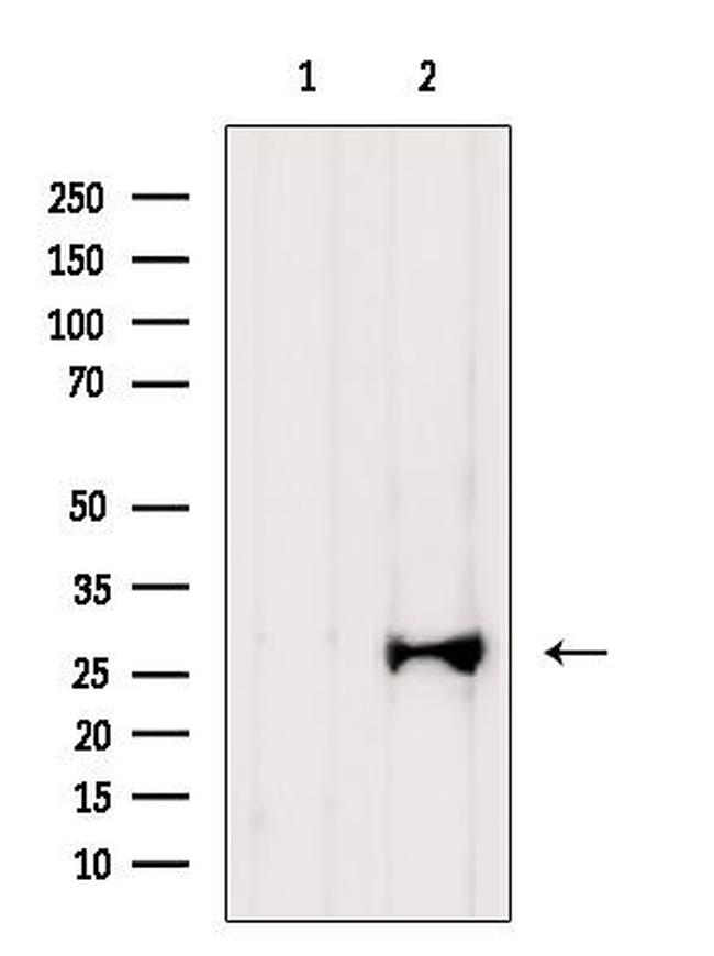 Amphiregulin Antibody in Western Blot (WB)