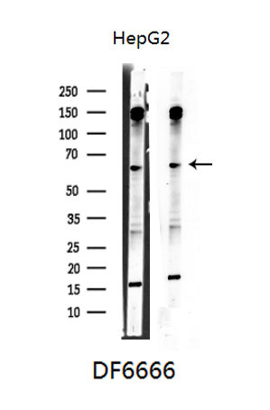 DKC1 Antibody in Western Blot (WB)