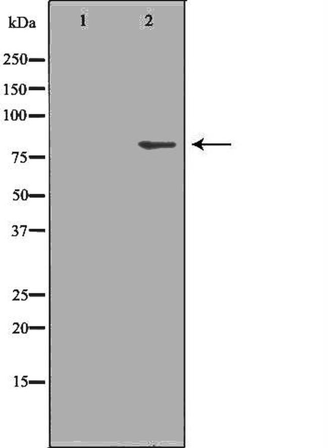 beta Galactosidase Antibody in Western Blot (WB)