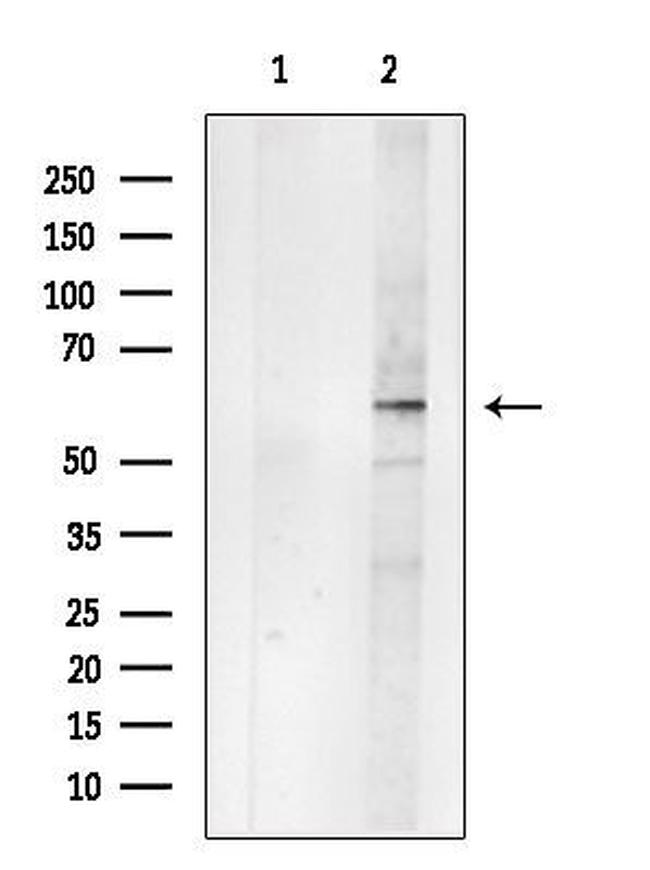 GABRB2 Antibody in Western Blot (WB)