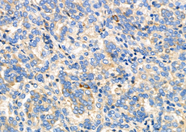 IL24 Antibody in Immunohistochemistry (Paraffin) (IHC (P))