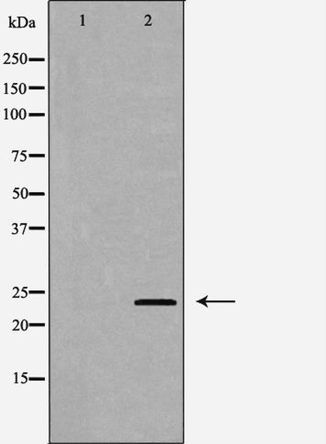 IL24 Antibody in Western Blot (WB)