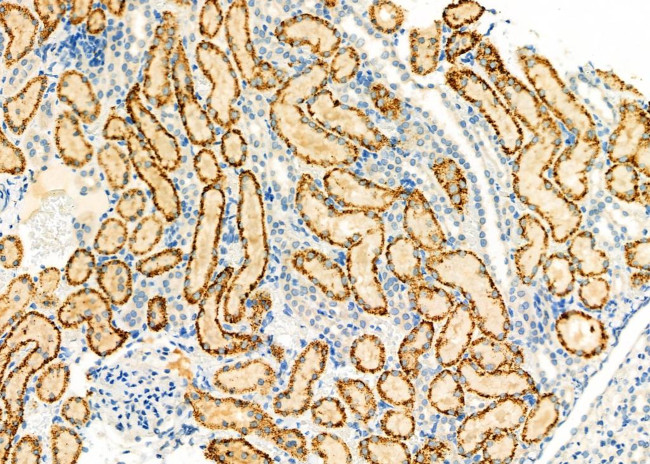 ANT Antibody in Immunohistochemistry (Paraffin) (IHC (P))