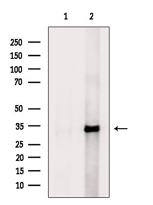 ANT Antibody in Western Blot (WB)